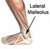External malleolus