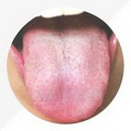 Thin Small Tongue,tongue coating thin and greasy