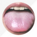 Enlarged Tongue,tongue coating thin and white
