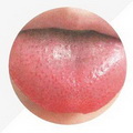 Tongue Proper Red,less tongue coating