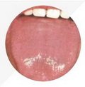 Tongue Proper Red,mirror-like tongue