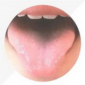 Thin Pale Tongue