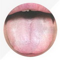 White Tongue Coating