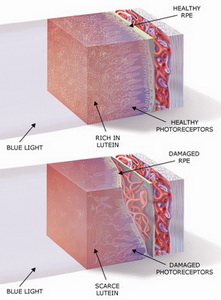 lutein and age-related macular degeneration